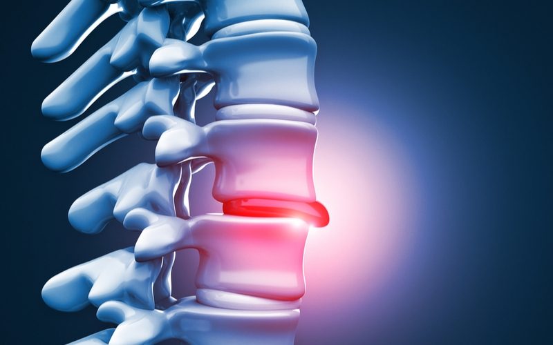 BẢO VỆ ĐĨA ĐỆM L4-L5, L5-S1 VỚI TƯ THẾ CHUẨN Y KHOA