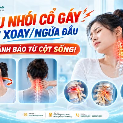 ĐAU NHÓI CỔ GÁY KHI XOAY/NGỬA ĐẦU: CẢNH BÁO TỪ CỘT SỐNG! 