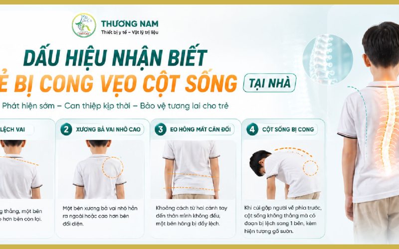 Dấu Hiệu Nhận Biết Con Bị Cong Vẹo Cột Sống Tại Nhà