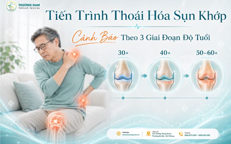 Tiến Trình Thoái Hóa Sụn Khớp: Cảnh Báo Theo Độ Tuổi!