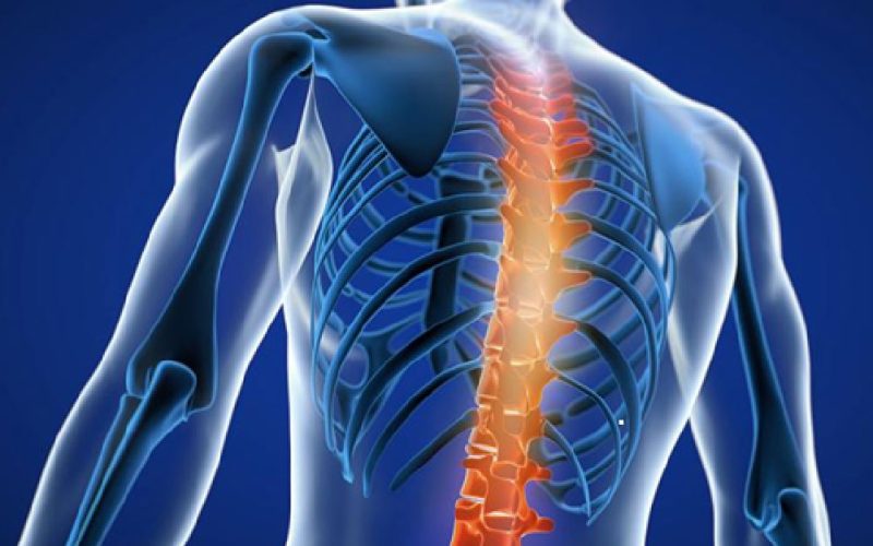 ĐAU CỘT SỐNG KHI VẬN ĐỘNG: DẤU HIỆU CẢNH BÁO TỔN THƯƠNG CƠ HỌC VÀ CHÈN ÉP THẦN KINH